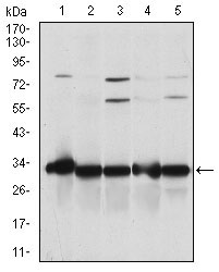 NQO1 Antibody - Western blot using NQO1 mouse monoclonal antibody against A549 (1), SKNES (2), HepG2 (3), MCF-7 (4) and HeLa (5) cell lysate.