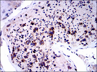 NQO1 Antibody - IHC of paraffin-embedded testis tissues using NQO1 mouse monoclonal antibody with DAB staining.