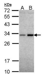 NQO1 Antibody - Sample (30 ug of whole cell lysate). A: Hela. B: Hep G2. 12% SDS PAGE. NQO1 antibody diluted at 1:1000. 