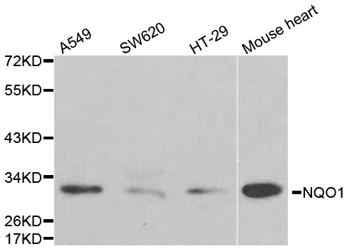 NQO1 Antibody - Western blot analysis of extracts of various cell lines, using NQO1 antibody at 1:1000 dilution. The secondary antibody used was an HRP Goat Anti-Rabbit IgG (H+L) at 1:10000 dilution. Lysates were loaded 25ug per lane and 3% nonfat dry milk in TBST was used for blocking.