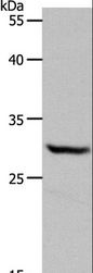 NQO1 Antibody - Western blot analysis of HeLa cell, using NQO1 Polyclonal Antibody at dilution of 1:600.