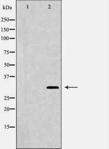 NQO1 Antibody - Western blot analysis of mouse kidney lysate using NQO1 antibody. The lane on the left is treated with the antigen-specific peptide.