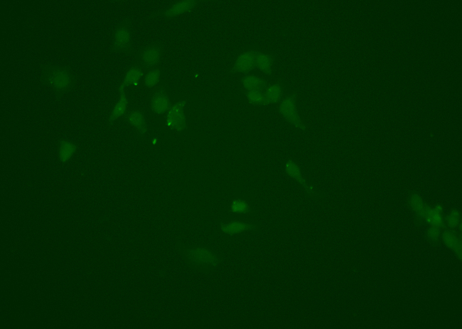 NQO1 Antibody - Staining HepG2 cells by IF/ICC. The samples were fixed with PFA and permeabilized in 0.1% saponin prior to blocking in 10% serum for 45 min at 37°C. The primary antibody was diluted 1:200 and incubated with the sample for 1 hour at 37°C. A Alexa Fluor 488 conjugated goat polyclonal to rabbit IgG (H+L), diluted 1/600 was used as secondary antibody.