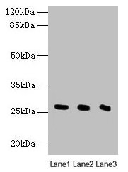 NQO2 Antibody - Western blot All lanes: Nqo2 antibody at 8µg/ml Lane 1: Rat heart tissue Lane 2: Mouse liver tissue Lane 3: Mouse kidney tissue Secondary Goat polyclonal to rabbit IgG at 1/10000 dilution Predicted band size: 26 kDa Observed band size: 26 kDa