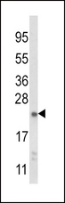 NQO2 Antibody - Western blot of NQO2 Antibody in mouse liver tissue lysates (35 ug/lane). NQO2 (arrow) was detected using the purified antibody.