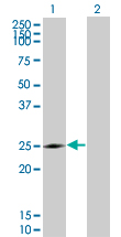 NQO2 Antibody - Western Blot analysis of NQO2 expression in transfected 293T cell line by NQO2 monoclonal antibody (M01), clone 3E8-G2.Lane 1: NQO2 transfected lysate(26 KDa).Lane 2: Non-transfected lysate.
