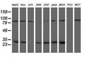 NQO2 Antibody - Western blot of extracts (35 ug) from 9 different cell lines by using g anti-NQO2 monoclonal antibody (HepG2: human; HeLa: human; SVT2: mouse; A549: human; COS7: monkey; Jurkat: human; MDCK: canine; PC12: rat; MCF7: human).