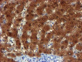 NQO2 Antibody - IHC of paraffin-embedded Human liver tissue using anti-NQO2 mouse monoclonal antibody.
