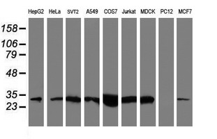 NQO2 Antibody - Western blot of extracts (35ug) from 9 different cell lines by using anti-NQO2 monoclonal antibody (HepG2: human; HeLa: human; SVT2: mouse; A549: human; COS7: monkey; Jurkat: human; MDCK: canine; PC12: rat; MCF7: human).