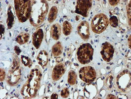NQO2 Antibody - IHC of paraffin-embedded Human Kidney tissue using anti-NQO2 mouse monoclonal antibody. (Heat-induced epitope retrieval by 10mM citric buffer, pH6.0, 100C for 10min).