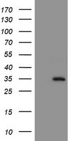 NQO2 Antibody - HEK293T cells were transfected with the pCMV6-ENTRY control (Left lane) or pCMV6-ENTRY NQO2 (Right lane) cDNA for 48 hrs and lysed. Equivalent amounts of cell lysates (5 ug per lane) were separated by SDS-PAGE and immunoblotted with anti-NQO2.