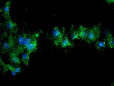 NQO2 Antibody - Anti-NQO2 mouse monoclonal antibody immunofluorescent staining of COS7 cells transiently transfected by pCMV6-ENTRY NQO2.