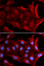 NQO2 Antibody - Immunofluorescence analysis of U20S cells.