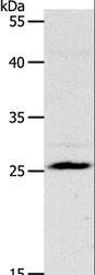 NQO2 Antibody - Western blot analysis of Mouse liver tissue, using NQO2 Polyclonal Antibody at dilution of 1:1200.