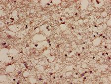 NQO2 Antibody - Immunohistochemistry image of paraffin-embedded human brain tissue at a dilution of 1:100