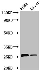 NQO2 Antibody - Positive Western Blot detected in K562 whole cell lysate, Mouse liver tissue. All lanes: NQO2 antibody at 3 µg/ml Secondary Goat polyclonal to rabbit IgG at 1/50000 dilution. Predicted band size: 26 KDa. Observed band size: 26 KDa