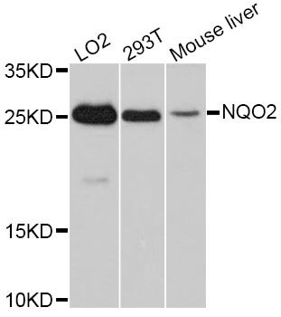 NQO2 Antibody - Western blot analysis of extracts of various cell lines, using NQO2 antibody at 1:3000 dilution. The secondary antibody used was an HRP Goat Anti-Rabbit IgG (H+L) at 1:10000 dilution. Lysates were loaded 25ug per lane and 3% nonfat dry milk in TBST was used for blocking. An ECL Kit was used for detection and the exposure time was 90s.