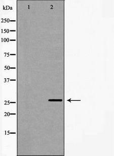 NQO2 Antibody - Western blot analysis of extracts of HeLa cells using NQO2 antibody. The lane on the left is treated with the antigen-specific peptide.