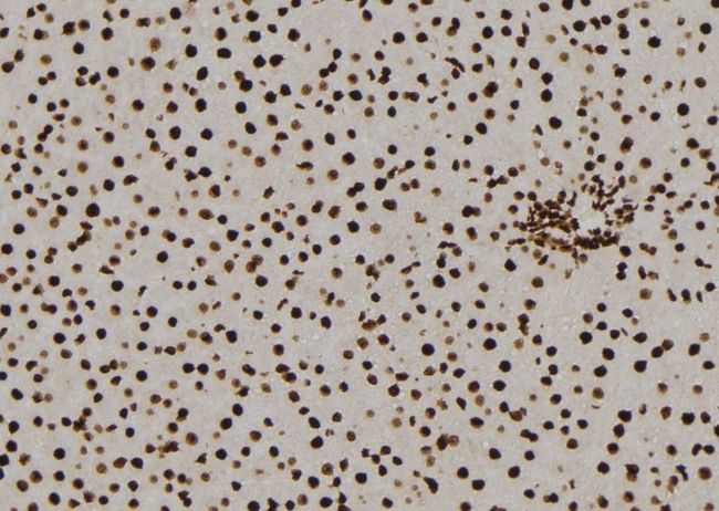 NQO2 Antibody - 1:100 staining rat liver tissue by IHC-P. The sample was formaldehyde fixed and a heat mediated antigen retrieval step in citrate buffer was performed. The sample was then blocked and incubated with the antibody for 1.5 hours at 22°C. An HRP conjugated goat anti-rabbit antibody was used as the secondary.