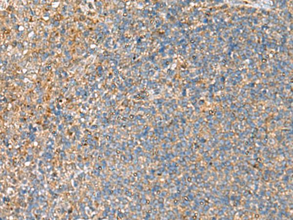 NQO2 Antibody - Immunohistochemistry of paraffin-embedded Human tonsil tissue  using NQO2 Polyclonal Antibody at dilution of 1:70(×200)