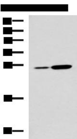NQO2 Antibody - Western blot analysis of Mouse kidney tissue and Mouse liver tissue lysates  using NQO2 Polyclonal Antibody at dilution of 1:1000