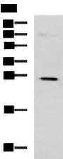 NQO2 Antibody - Western blot analysis of K562 cell lysate  using NQO2 Polyclonal Antibody at dilution of 1:650