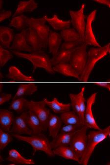 NQO2 Antibody - Immunofluorescence analysis of U2OS cells using NQO2 Polyclonal Antibody.