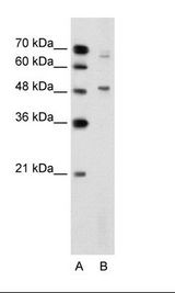 NR0B1 / DAX1 Antibody - A: Marker, B: Jurkat Cell Lysate.  This image was taken for the unconjugated form of this product. Other forms have not been tested.