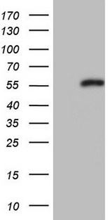 NR0B1 / DAX1 Antibody - HEK293T cells were transfected with the pCMV6-ENTRY control. (Left lane) or pCMV6-ENTRY NR0B1. (Right lane) cDNA for 48 hrs and lysed. Equivalent amounts of cell lysates. (5 ug per lane) were separated by SDS-PAGE and immunoblotted with anti-NR0B1.
