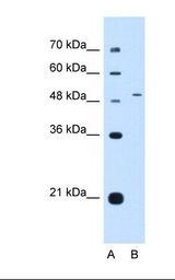 NR0B1 / DAX1 Antibody - Lane A: Marker. Lane B: HepG2 cell lysate. Antibody concentration: 0.5 ug/ml. Gel concentration: 12%.  This image was taken for the unconjugated form of this product. Other forms have not been tested.