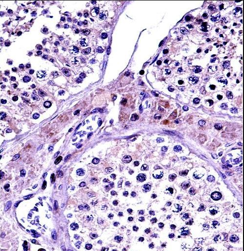 NR0B1 / DAX1 Antibody - NR0B1 Antibody immunohistochemistry of formalin-fixed and paraffin-embedded human testis tissue followed by peroxidase-conjugated secondary antibody and DAB staining.