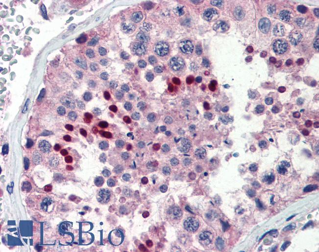 NR0B1 / DAX1 Antibody - Anti-DAX1 antibody IHC of human testis. Immunohistochemistry of formalin-fixed, paraffin-embedded tissue after heat-induced antigen retrieval. Antibody concentration 5 ug/ml.  This image was taken for the unconjugated form of this product. Other forms have not been tested.