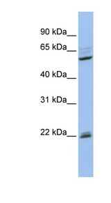 NR0B1 / DAX1 Antibody - NR0B1 / DAX-1 antibody Western blot of MCF7 cell lysate. This image was taken for the unconjugated form of this product. Other forms have not been tested.