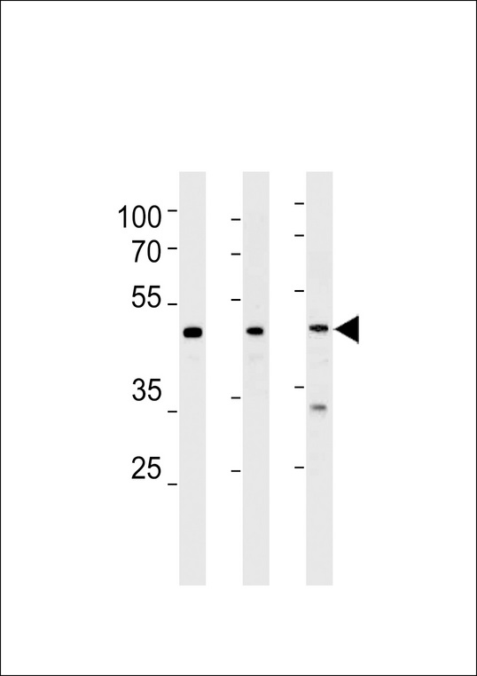 NR0B1 / DAX1 Antibody - NROB1 Antibody western blot of HeLa,NCI-H292,PC-3 cell line lysates (35 ug/lane). The NROB1 antibody detected the NROB1 protein (arrow).