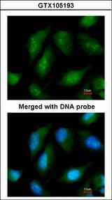 NR0B1 / DAX1 Antibody - Immunofluorescence of paraformaldehyde-fixed HeLa using DAX-1 antibody at 1:200 dilution.
