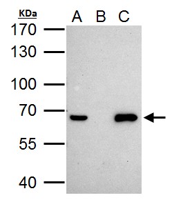 NR0B1 / DAX1 Antibody - NRB1 antibody immunoprecipitates NRB1 protein in IP experiments. IP Sample: HeLa whole cell lysate/extract A. 40 ug HeLa whole cell lysate/extract B. Control with 2 ug of preimmune rabbit IgG C. Immunoprecipitation of NRB1 protein by 2 ug of NRB1 antibody 7.5% SDS-PAGE The immunoprecipitated NRB1 protein was detected by NRB1 antibody diluted at 1:1000. EasyBlot anti-rabbit IgG (anti-rabbit IgG (HRP) -01) was used as a secondary reagent.