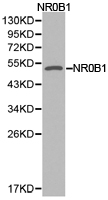 NR0B1 / DAX1 Antibody - Western blot of extracts of NR0B1 protein, using NR0B1 antibody.