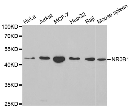 NR0B1 / DAX1 Antibody - Western blot analysis of extracts of various cell lines, using NR0B1 antibody at 1:1000 dilution. The secondary antibody used was an HRP Goat Anti-Rabbit IgG (H+L) at 1:10000 dilution. Lysates were loaded 25ug per lane and 3% nonfat dry milk in TBST was used for blocking.