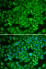 NR0B1 / DAX1 Antibody - Immunofluorescence analysis of U2OS cells using NR0B1 antibody. Blue: DAPI for nuclear staining.