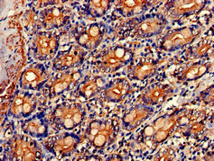 NR0B1 / DAX1 Antibody - Immunohistochemistry of paraffin-embedded human small intestine tissue at dilution of 1:100