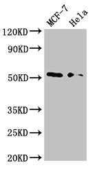 NR0B1 / DAX1 Antibody - Western Blot Positive WB detected in:MCF-7 whole cell lysate,Hela whole cell lysate All Lanes:NR0B1 antibody at 2.8µg/ml Secondary Goat polyclonal to rabbit IgG at 1/50000 dilution Predicted band size: 52,44 KDa Observed band size: 52 KDa