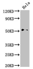 NR0B1 / DAX1 Antibody - Western Blot Positive WB detected in: Hela whole cell lysate All lanes: NR0B1 antibody at 2.8µg/ml Secondary Goat polyclonal to rabbit IgG at 1/50000 dilution Predicted band size: 52, 44 kDa Observed band size: 52 kDa
