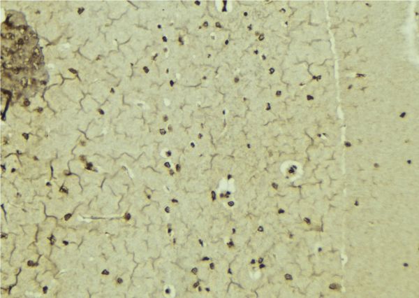 NR0B1 / DAX1 Antibody - 1:100 staining mouse brain tissue by IHC-P. The sample was formaldehyde fixed and a heat mediated antigen retrieval step in citrate buffer was performed. The sample was then blocked and incubated with the antibody for 1.5 hours at 22°C. An HRP conjugated goat anti-rabbit antibody was used as the secondary.