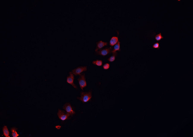 NR0B1 / DAX1 Antibody - Staining HepG2 cells by IF/ICC. The samples were fixed with PFA and permeabilized in 0.1% Triton X-100, then blocked in 10% serum for 45 min at 25°C. The primary antibody was diluted at 1:200 and incubated with the sample for 1 hour at 37°C. An Alexa Fluor 594 conjugated goat anti-rabbit IgG (H+L) antibody, diluted at 1/600, was used as secondary antibody.