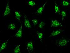 NR0B1 / DAX1 Antibody - Immunofluorescence staining of NR0B1 in HeLa cells. Cells were fixed with 4% PFA, permeabilzed with 0.3% Triton X-100 in PBS, blocked with 10% serum, and incubated with rabbit anti-Human NR0B1 polyclonal antibody (dilution ratio 1:1000) at 4°C overnight. Then cells were stained with the Alexa Fluor 488-conjugated Goat Anti-rabbit IgG secondary antibody (green). Positive staining was localized to cytoplasm and nucleus.