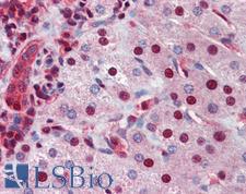 NR0B2 Antibody - Anti-NR0B2 antibody IHC of human liver. Immunohistochemistry of formalin-fixed, paraffin-embedded tissue after heat-induced antigen retrieval. Antibody concentration 5 ug/ml.  This image was taken for the unconjugated form of this product. Other forms have not been tested.