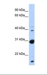 NR0B2 Antibody - Transfected 293T cell lysate. Antibody concentration: 1.0 ug/ml. Gel concentration: 12%.  This image was taken for the unconjugated form of this product. Other forms have not been tested.