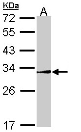 NR0B2 Antibody - Sample (30 ug of whole cell lysate). A: Molt-4 . 12% SDS PAGE. NR0B2 / SHP antibody diluted at 1:1000.
