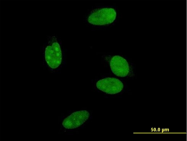 NR0B2 Antibody - Immunofluorescence of monoclonal antibody to NR0B2 on HeLa cell . [antibody concentration 10 ug/ml]