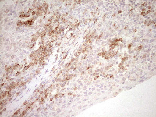NR0B2 Antibody - Immunohistochemical staining of paraffin-embedded Human tonsil within the normal limits using anti-NR0B2 mouse monoclonal antibody. (Heat-induced epitope retrieval by Tris-EDTA, pH8.0) Dilution: 1:150